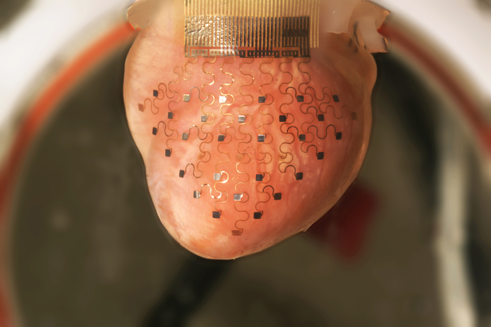 efimov_heart_membrane