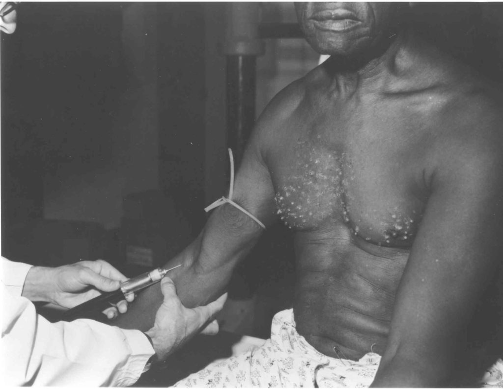 Blood test and unidentified subject (National Archives, Atlanta, GA)