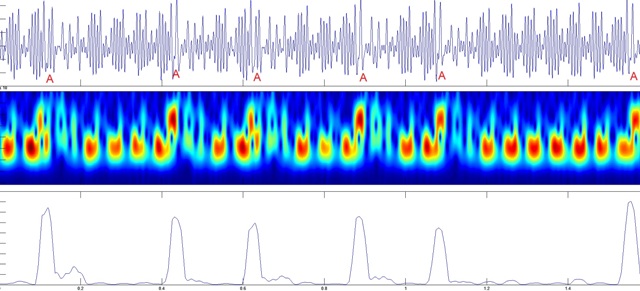 Image Source: IARC - Several stages of our approach for distinguishing between double and add operations. The topmost gure is the aggregated segment corresponding to the bottom two gures, with the locations of addition operations marked. The middle gure is the spectrogram of the aggregated segment, where blue denotes frequencies with low-energy and red denotes frequencies with high energy. In this gure the horizontal frequency is time (0-1.6 msec) while the vertical axis is frequency (0{400 kHz). The bottom gure gives the nal result of the processing, clearly showing the locations of the addition operations.
