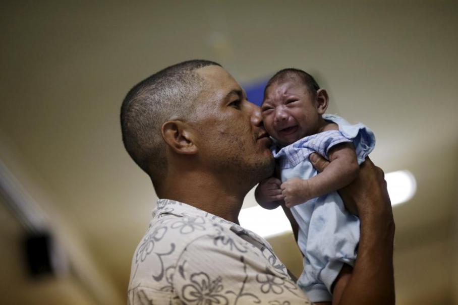 zika-virus-microcephaly