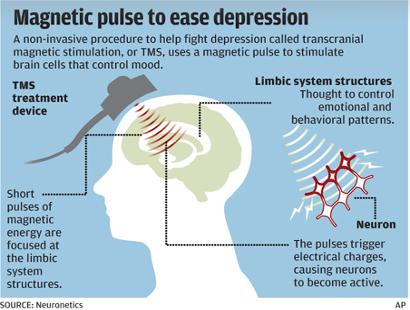 Releasing Depression