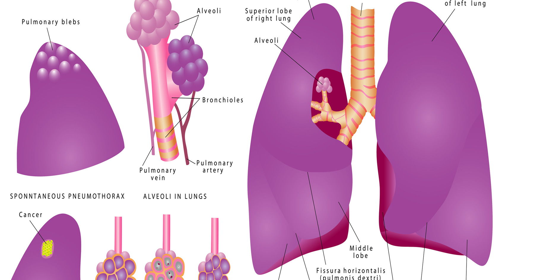 What Does Marijuana Do To Your Lungs
