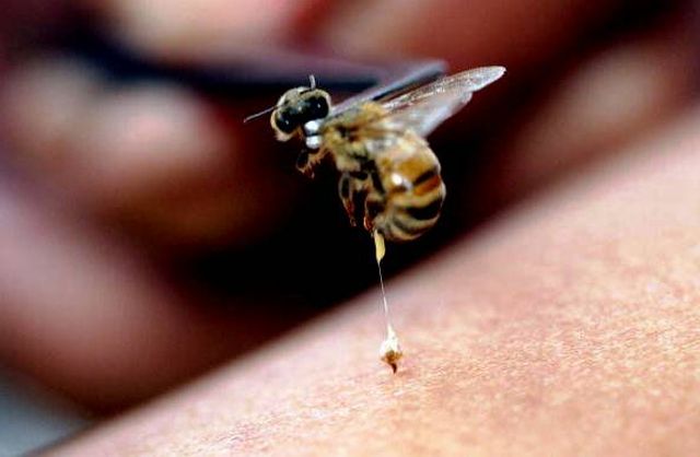 Bee Venom HIV AIDS