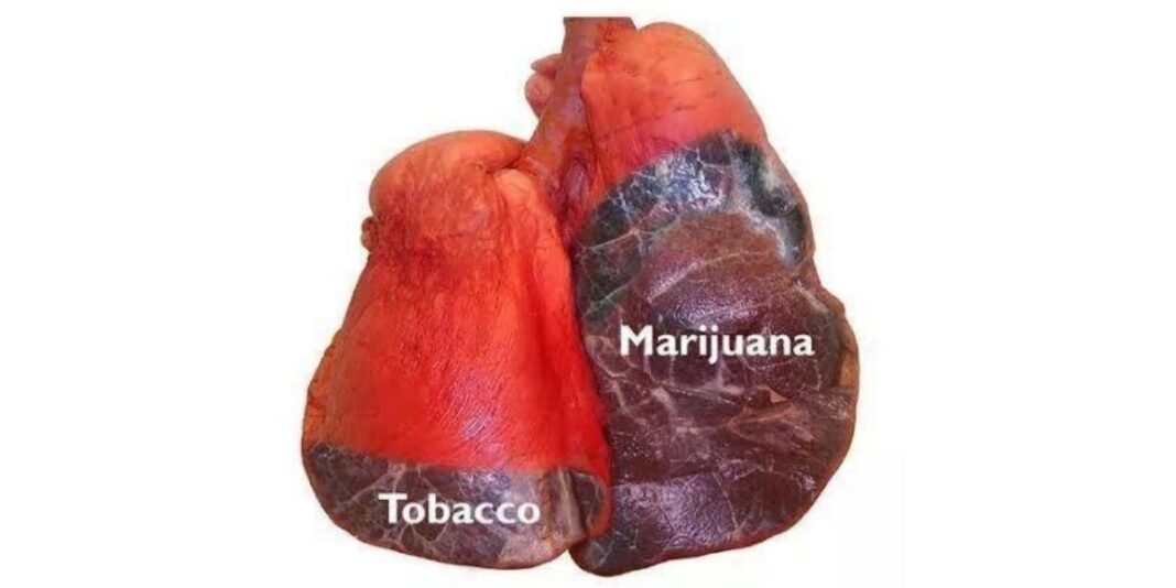 What Does Marijuana Do To Your Lungs?